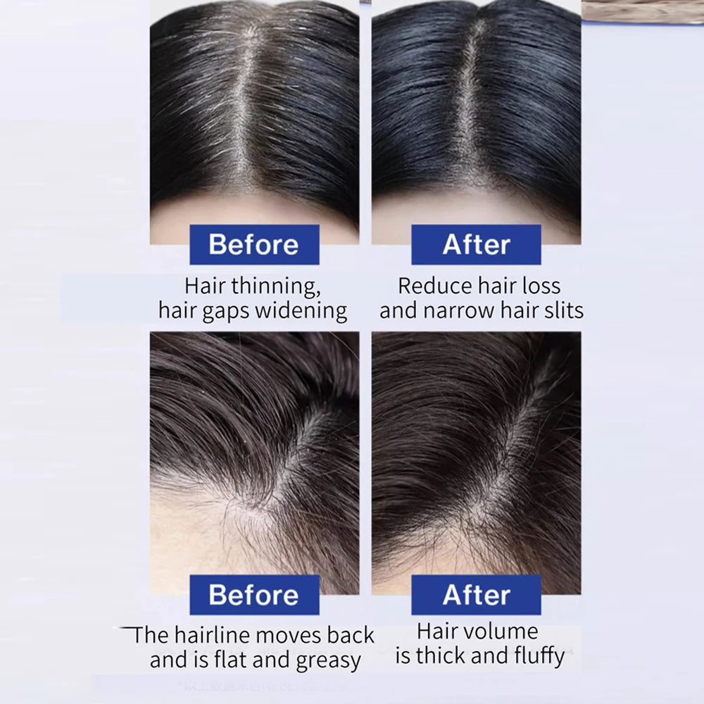 FEG Plus Hair Growth Spray – Organic Scalp Nourishing & Hair Loss Treatment for Men & Women (50ml)
